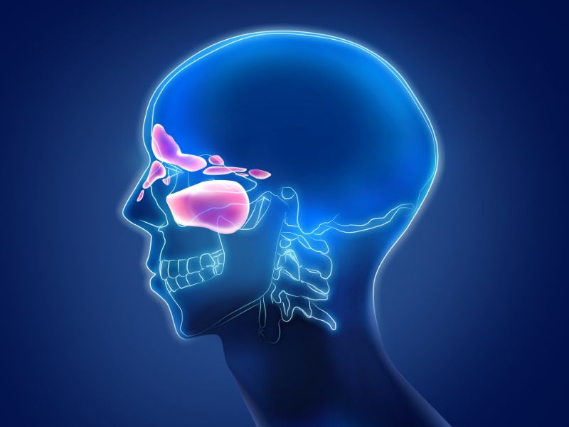Đừng chủ quan những dấu hiệu của bệnh viêm xoang Đừng chủ quan những dấu hiệu của bệnh viêm xoang