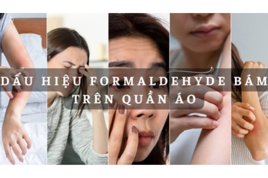 Điều không ai ngờ tới Formaldehit trong quần áo ảnh hưởng sức khỏe_5
