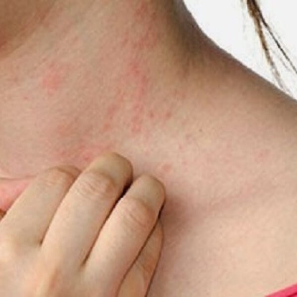 Nguy cơ đối với cơ thể đến từ formaldehit trong vải_3