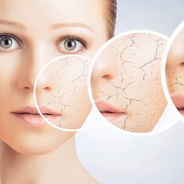 Ảnh hưởng của độ ẩm không khí trời hanh khô tới sức khỏe_2