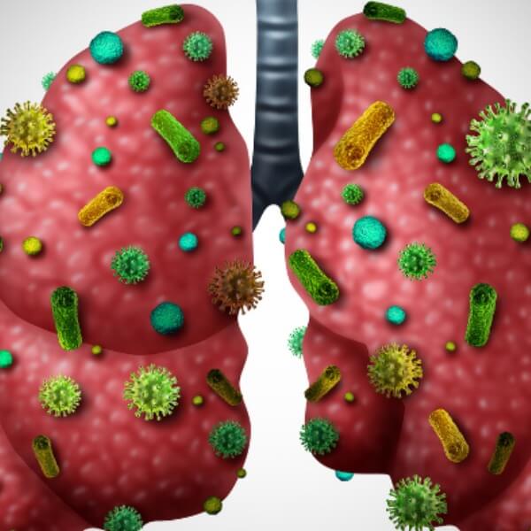 Nguyên nhân bệnh viêm phổi trẻ em _5