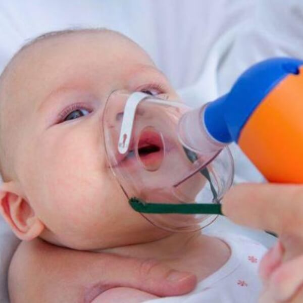 Nguyên nhân gây bệnh viêm phổi cấp_3