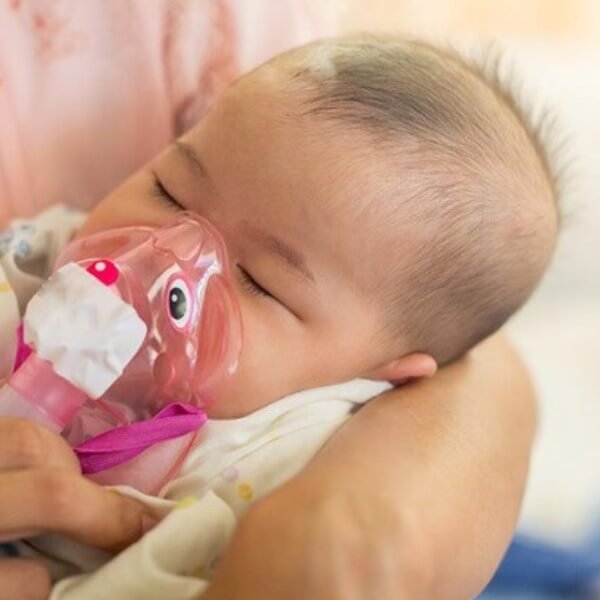 Nguyên nhân viêm phế quản do RSV ở trẻ sơ sinh_4