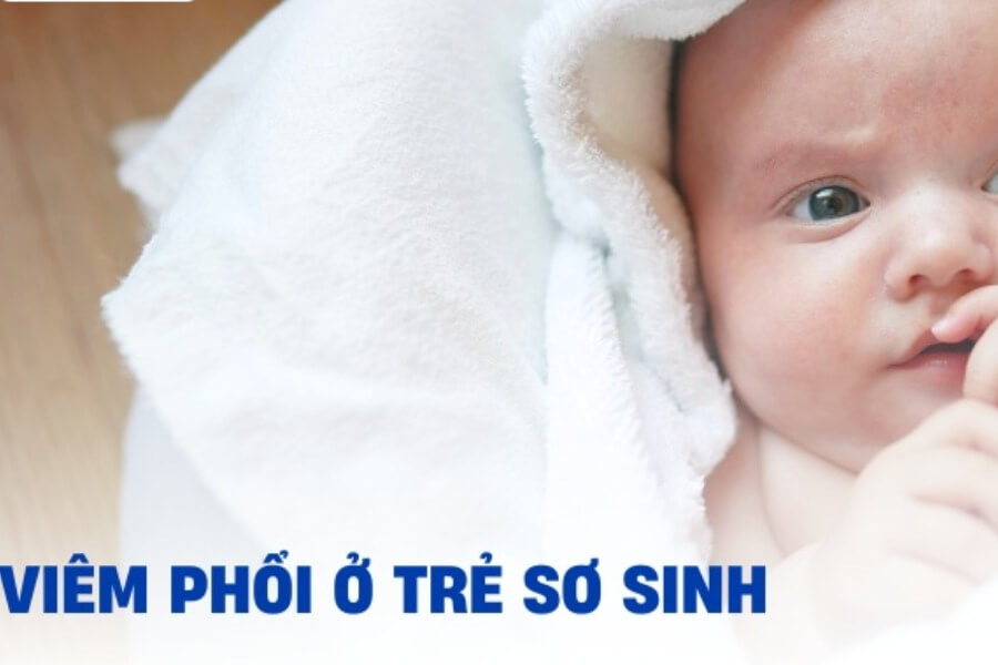 Viêm phổi trẻ em Nguyên nhân, triệu chứng, chẩn đoán và điều trị_1