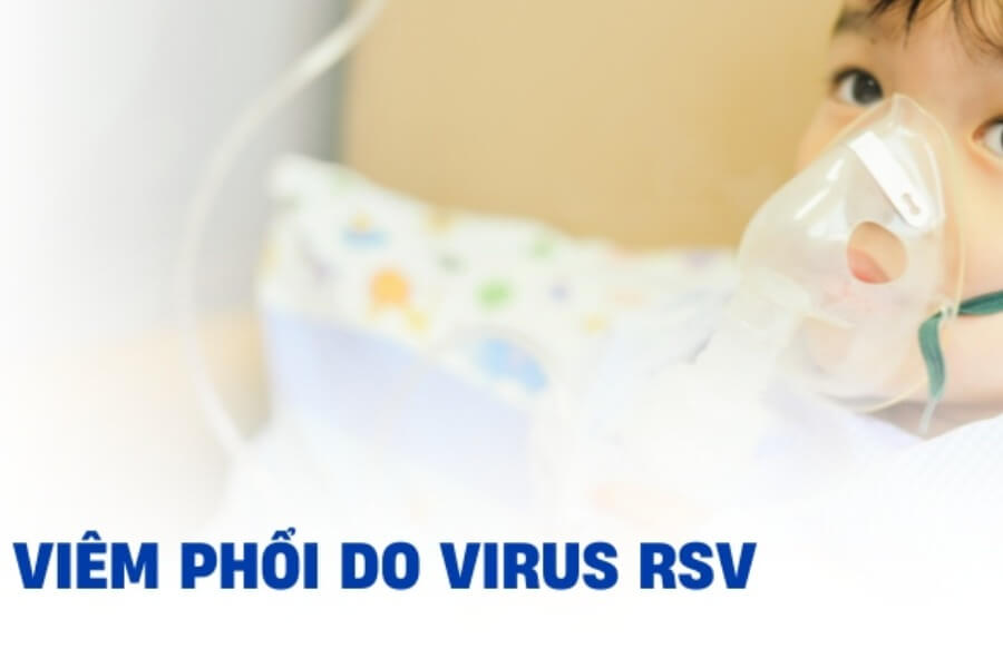 Virus RSV gây bệnh gì ở trẻ em Biểu hiện và cách điều trị_1