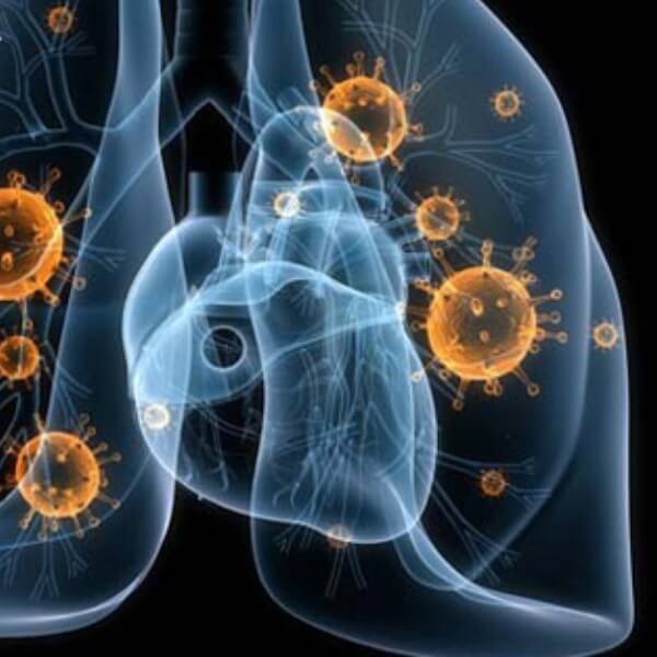 Ảnh hưởng của bụi mịn đến sức khỏe_2