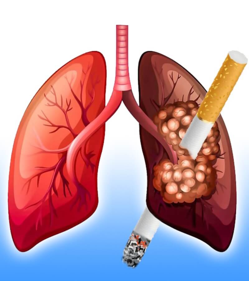 Các bệnh do thuốc lá gây ra gồm những bệnh gì_2
