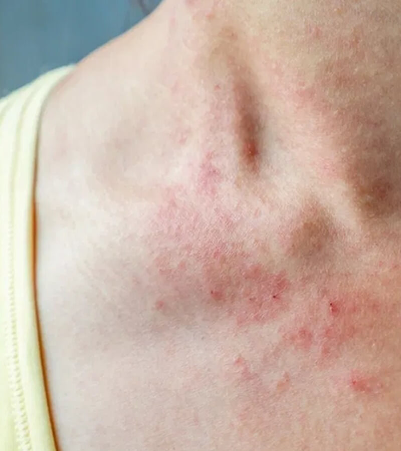 Các nguyên nhân gây ra tình trạng dị ứng bụi_3