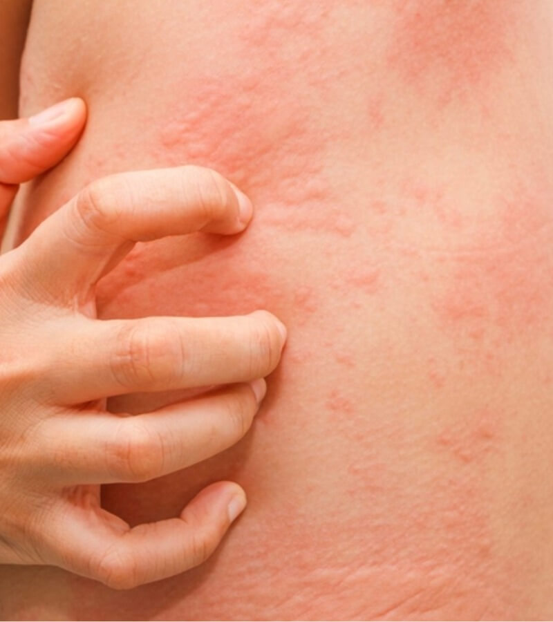 Nấm mốc mùa mưa ảnh hưởng trực tiếp đến sức khỏe_4