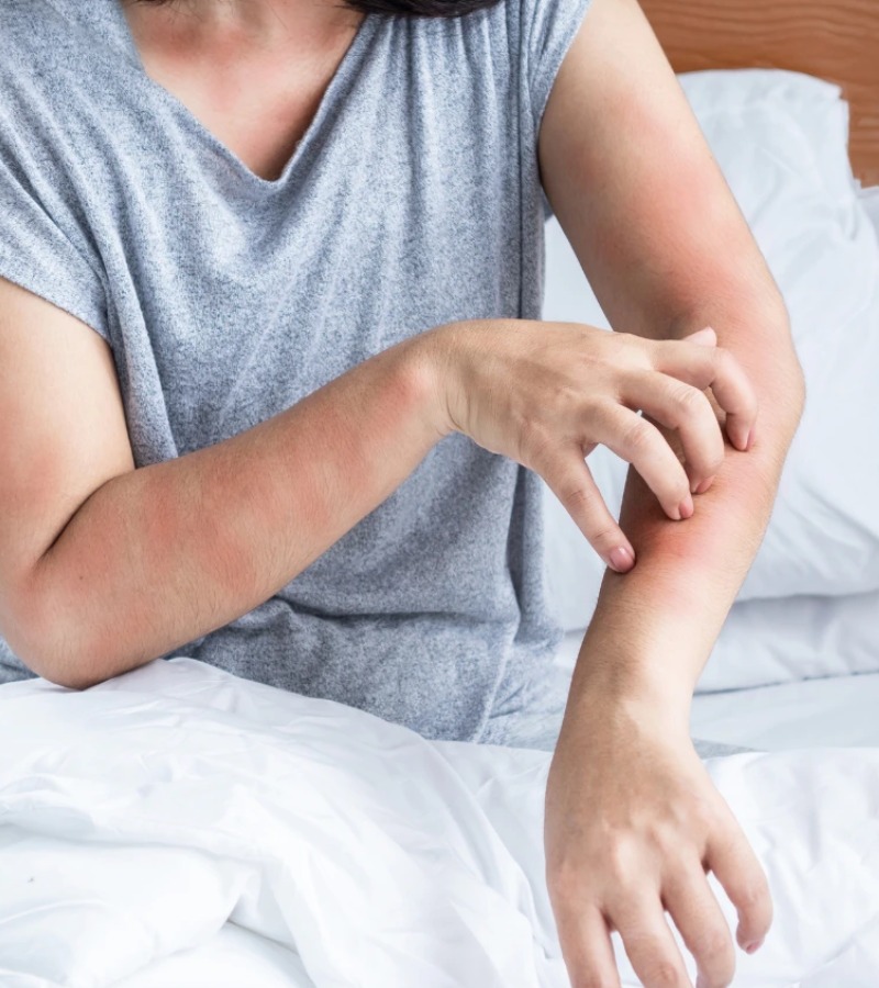 Bị dị ứng bụi vải là gì