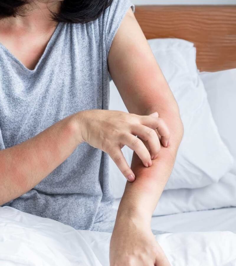 Các dấu hiệu khi bị dị ứng mạt bụi_2
