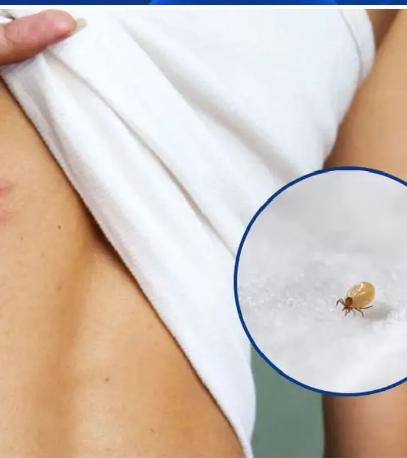 Nguyên nhân gây dị ứng mạt bụi nhà_5
