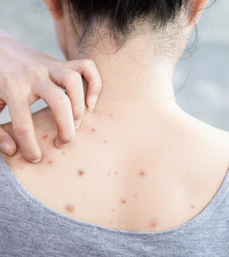 Vì sao tiếp xúc với bụi có thể khiến da dễ kích ứng và nổi nốt_4